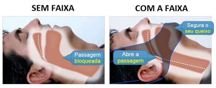 faixa-antironco-2